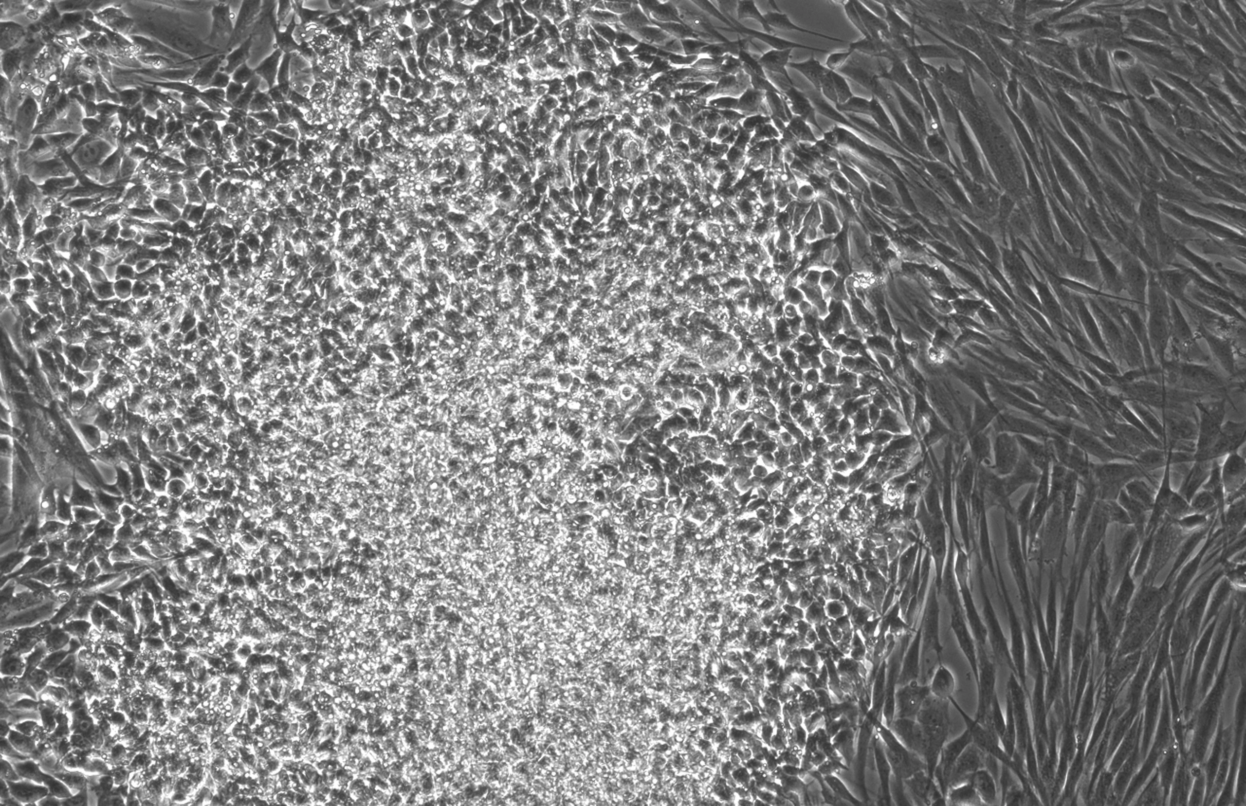 Microscopy image of cells reprogrammed with RetroSOX, RetroKLF, OCT4, and MYC at day 10, showing a dense colony of tightly packed cells with defined borders surrounded by elongated fibroblast-like cells; scale bar indicates 400 µm.