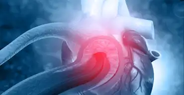 Preventing HF