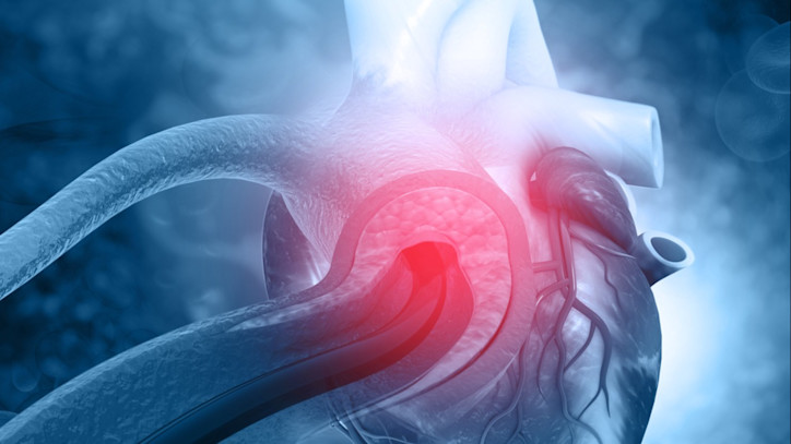 Causas y prevención de la insuficiencia cardíaca