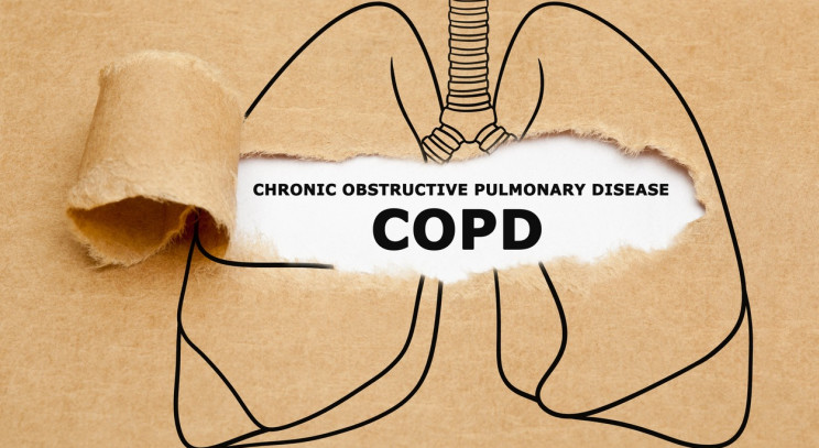 Is it COPD?