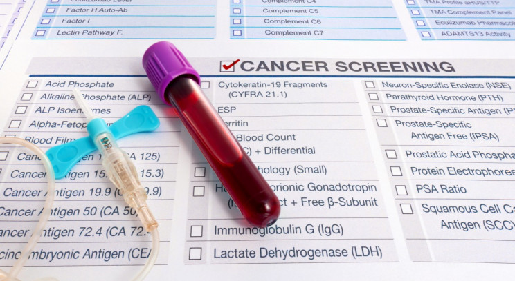 Should Older Adults be Screened for Common Cancers?
