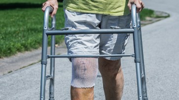 What Happens After Knee Arthroplasty (Replacement)?