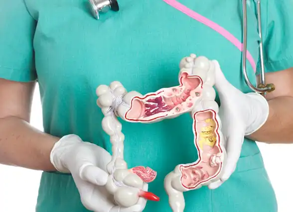 What to Expect from a Colonoscopy or FIT Test