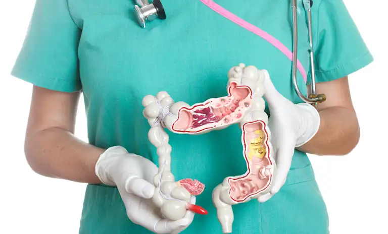 What to Expect from a Colonoscopy or FIT Test