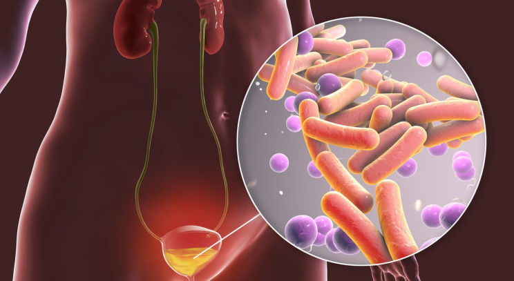 When is Bacteria in Urine NOT a Urinary Tract Infection?