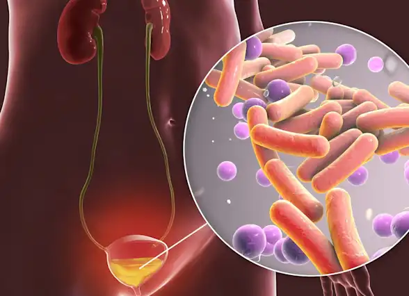 Asymptomatic Bacteriuria