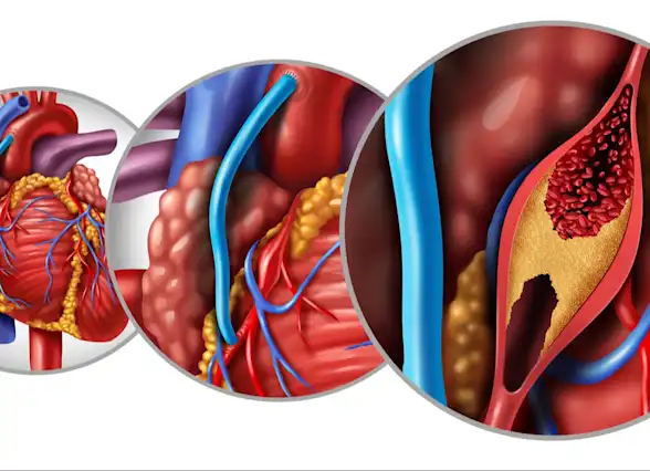 CABG Deifnition
