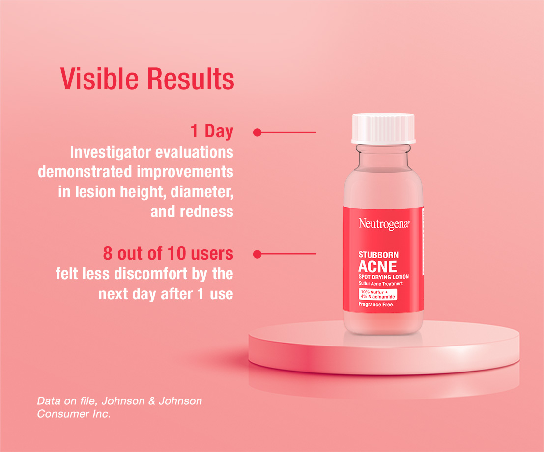 Neutrogena Stubborn Acne Visible Results