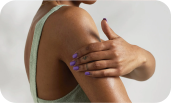 Eczema in Skin of Colour