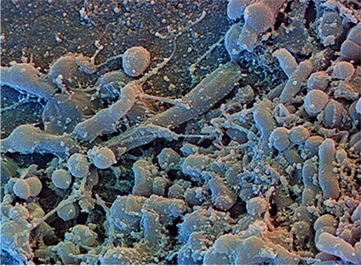 Plaque biofilm