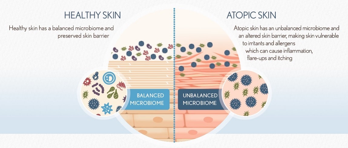 AVEENO® research on skin microbiome