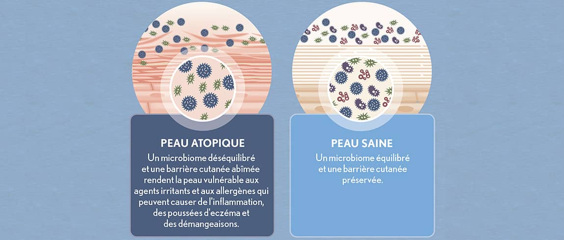 AVEENO® research on skin microbiome