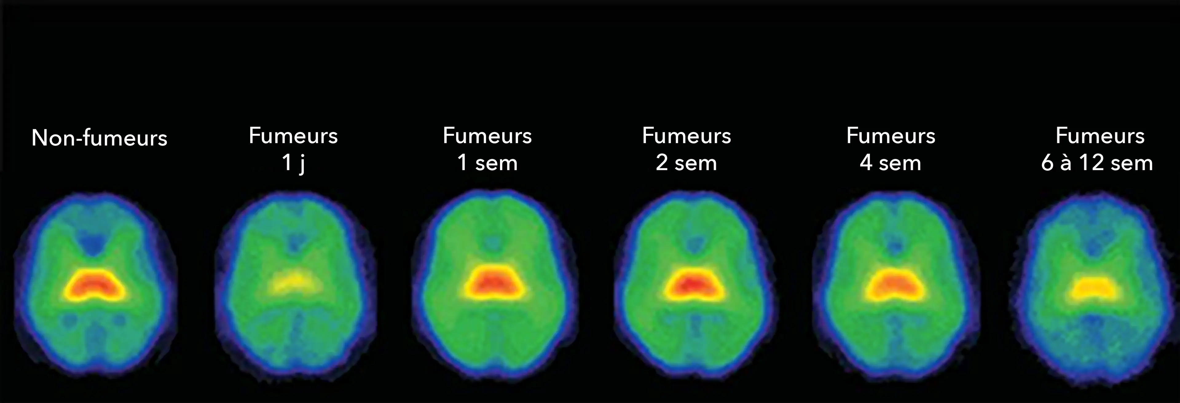 Image of brain regions using SPECT imaging