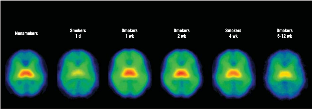Image of brain regions using SPECT imaging