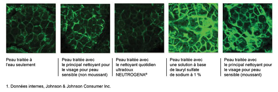 Image de fluorescence PHM