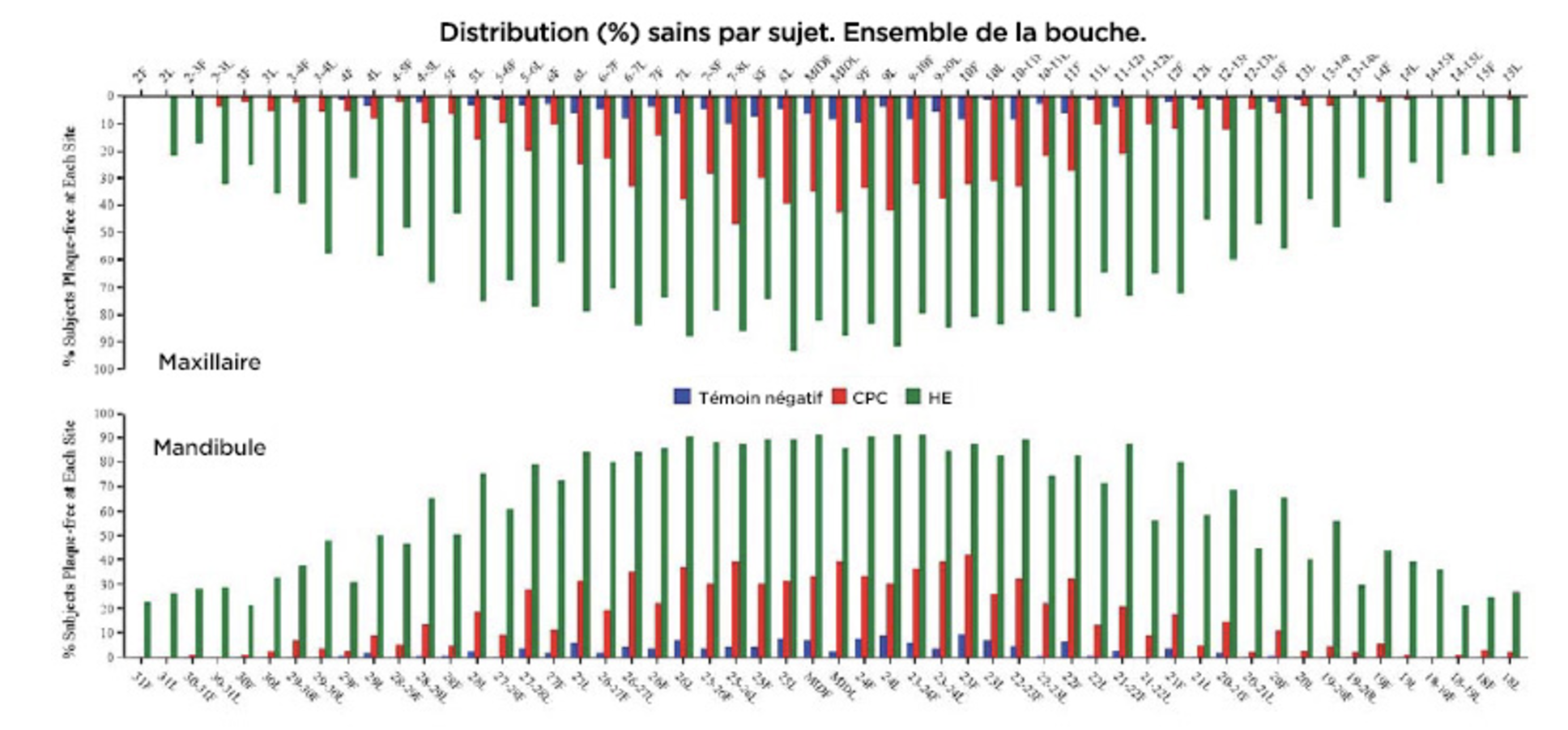 Étude de Cortelli