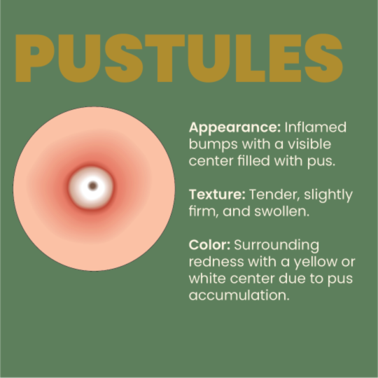 Pustules