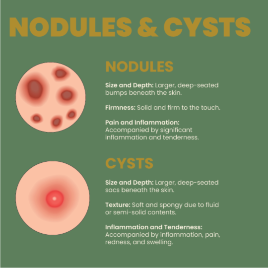 Nodules & Cysts