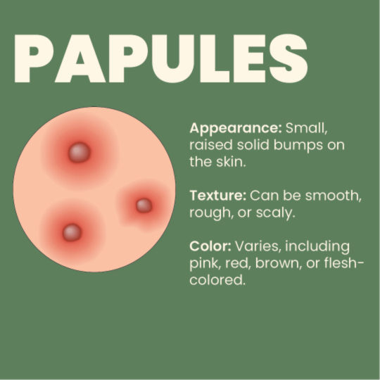 Papules