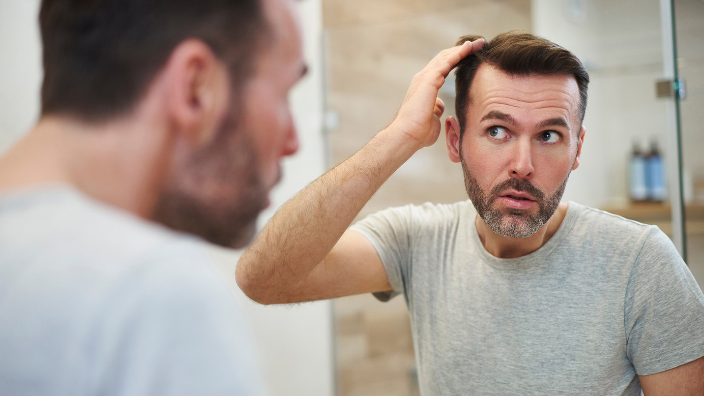 man looking at his thinning hair in mirror