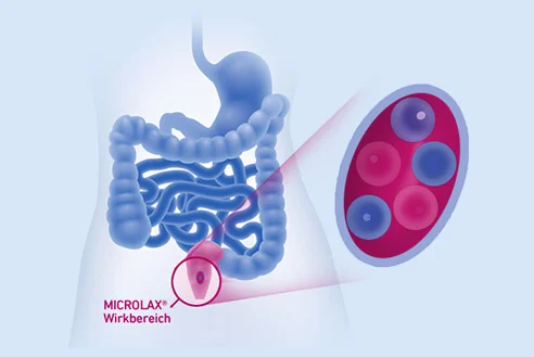1 microlax wirkweise-verstopfung 492x329