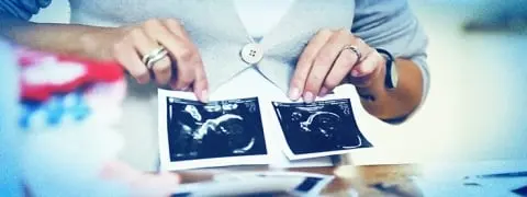 Hebammensuche: Finde deine perfekte Hebamme
