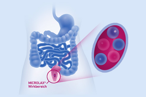 microlax wirkweise-verstopfung 492x329