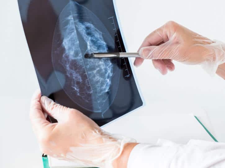 detection of breast cancer with regular mammograms
