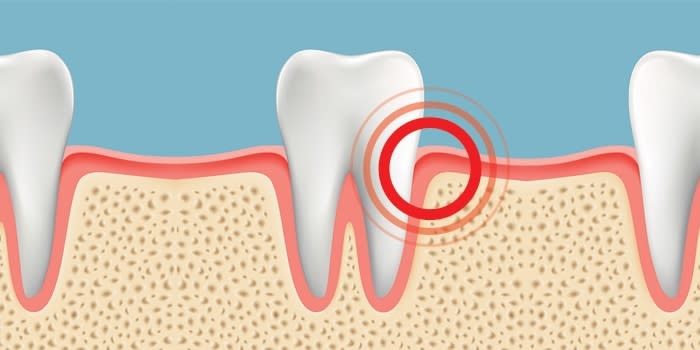 Gum Pain Causes Relief And Treatments Crest Ca