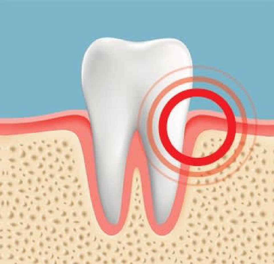 Inflamed Gums: Causes and Treatments for Gum Swelling | Crest