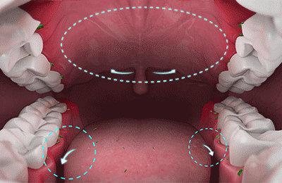 mouthcavity