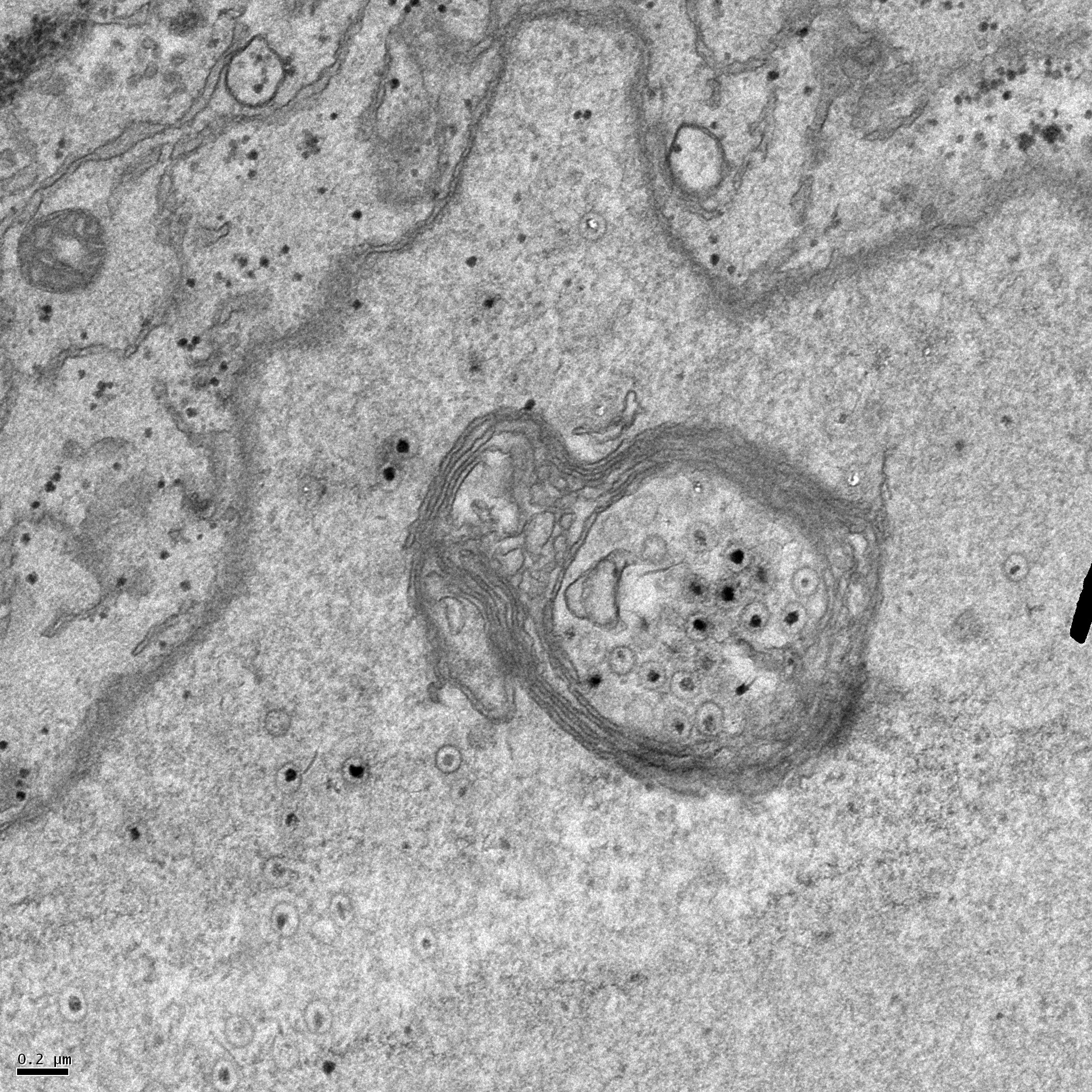 Generating More Robustly Infected Cell Lines by Co-Culture Infection