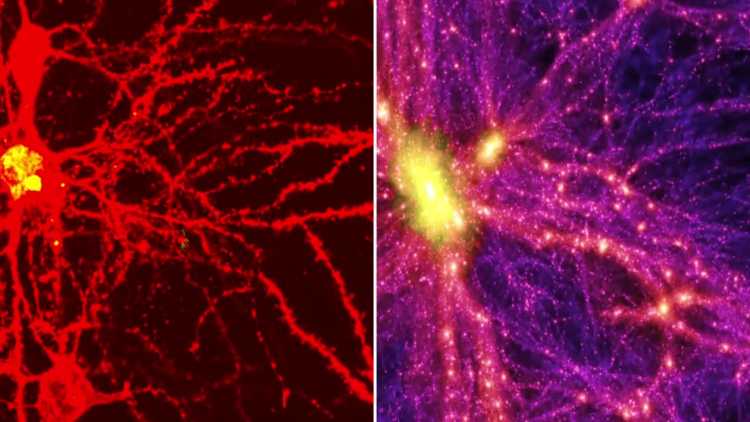 growth patterns of universe and brain cell