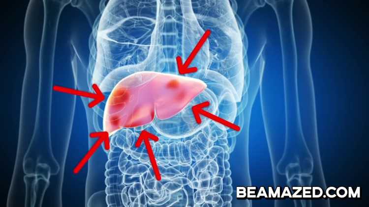 andreas liver tumor