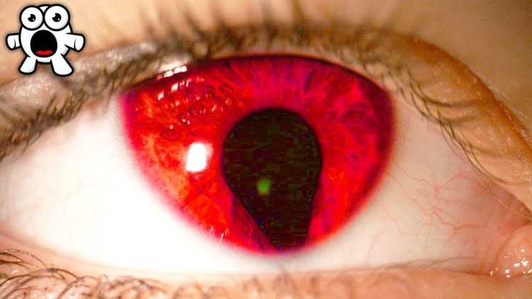 Rarest Eye Colours Spotted in Humans