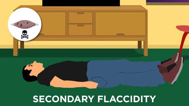 secondary flaccidity