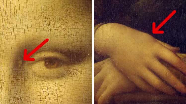 Mona Lisa Secrets You Aren't Aware Of high cholesterol lipoma Xanthelasma