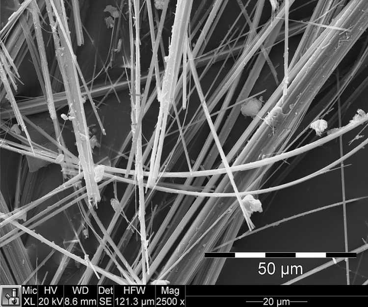 Asbestos fibres microscope 