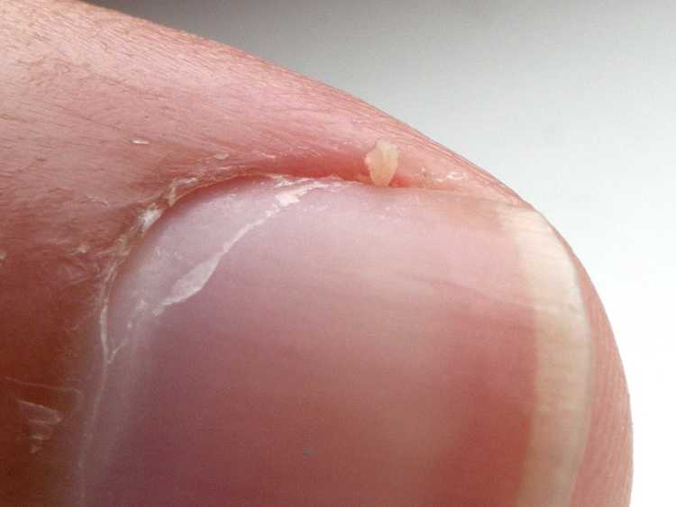fingernail nail cuticle lunula