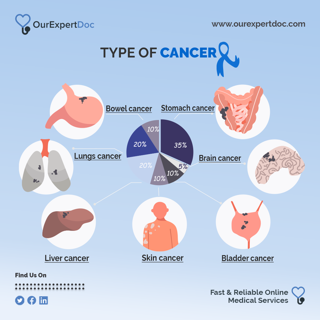 Infographic showing common types of cancer with illustrations and percentages, including bowel cancer, stomach cancer, brain cancer, lung cancer, liver cancer, skin cancer, and bladder cancer.