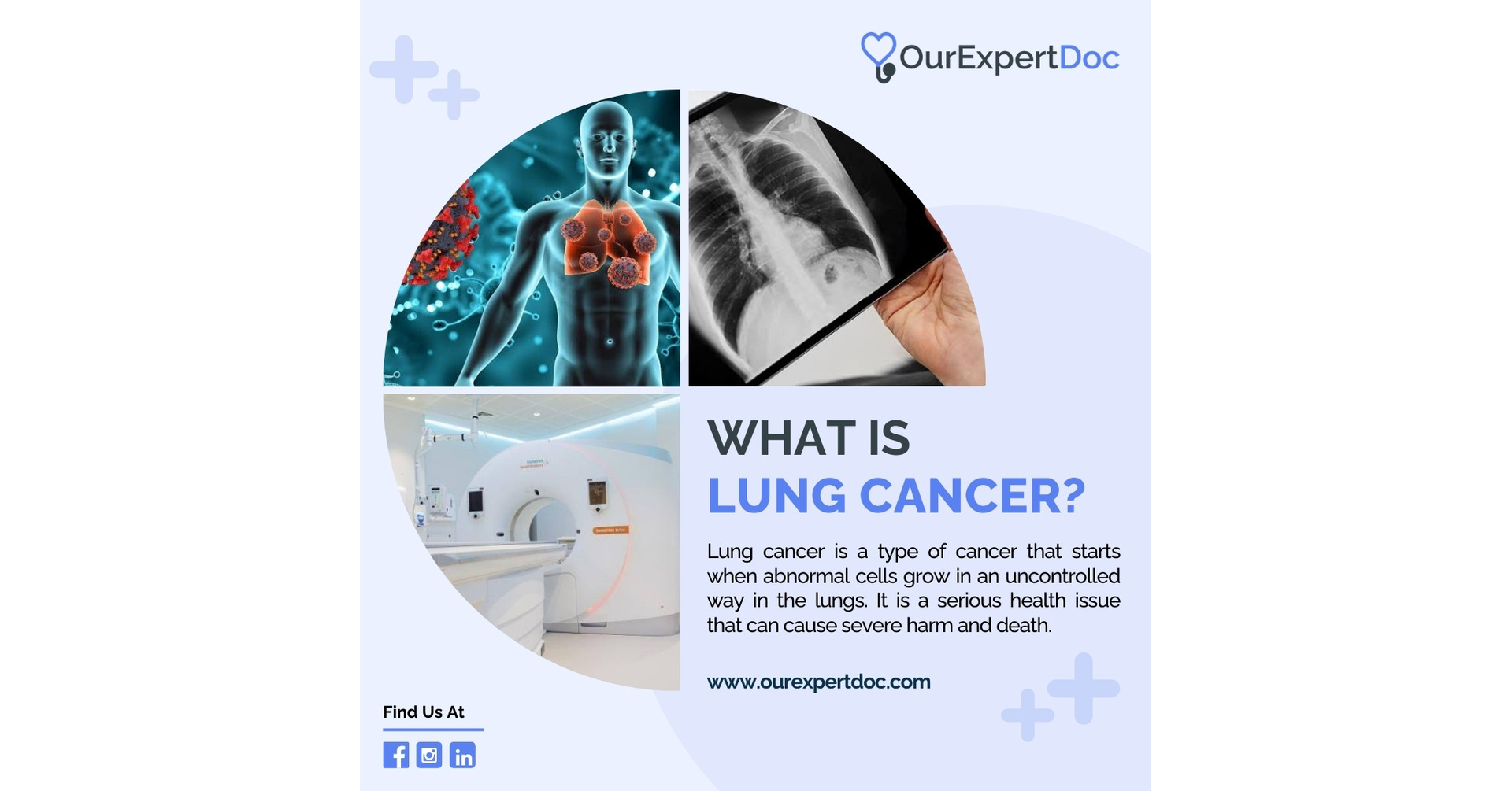 temp alt text for lung cancer