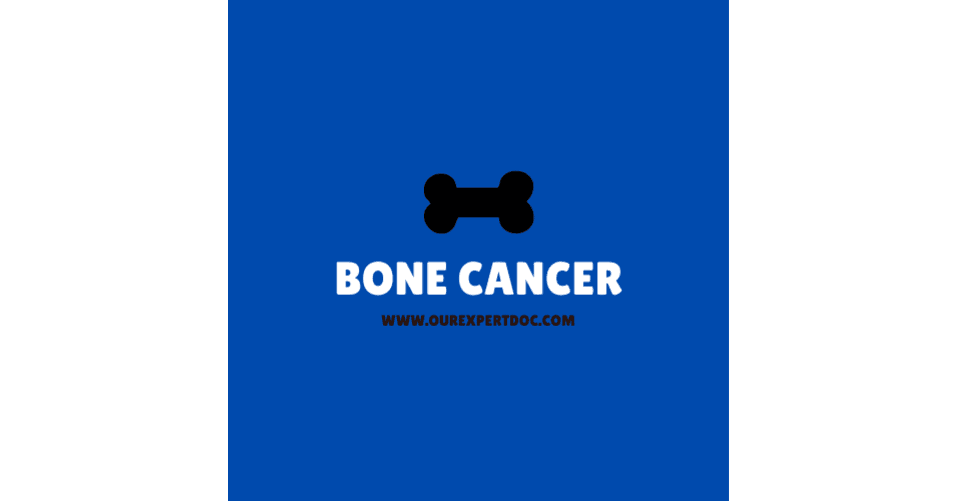 Bone Cancer featured image by ourexpertdoc 
