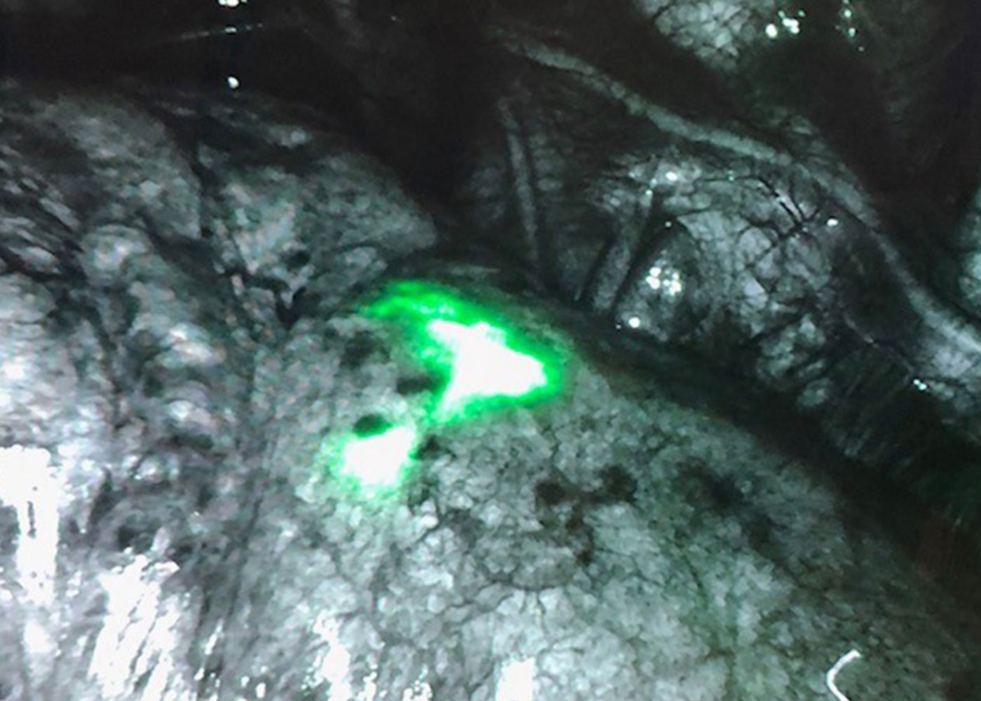 Fig 4. Indocyanine green tattoo during resection