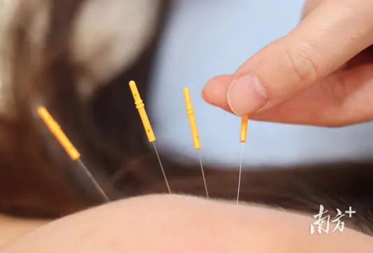 中国で進むパーキンソン病への針灸治療研究
