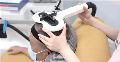 台湾の73歳男性　杭州の無侵襲脳治療で歩行と睡眠が改善