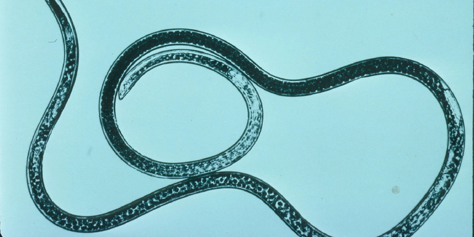 Nematode, Longidorus spp., female ©Broom's Barn Research Centre.