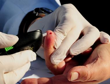 Self-Monitoring of Blood Glucose: The Key to Effective Diabetes Treatment