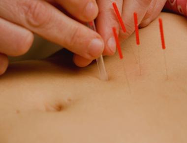 Acupuncture Found to be Effective in Treating Diabetes