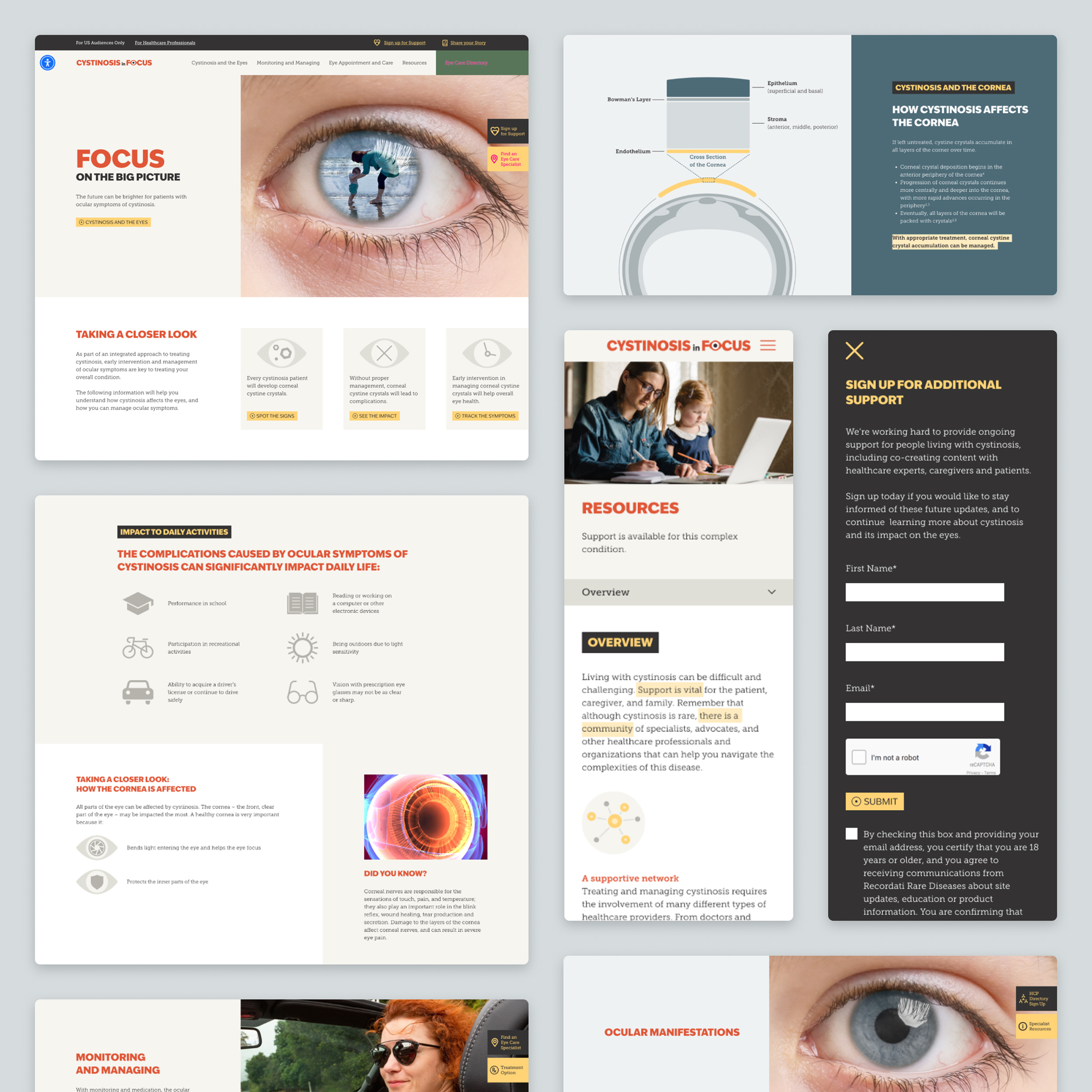 case-study cystinosis 01