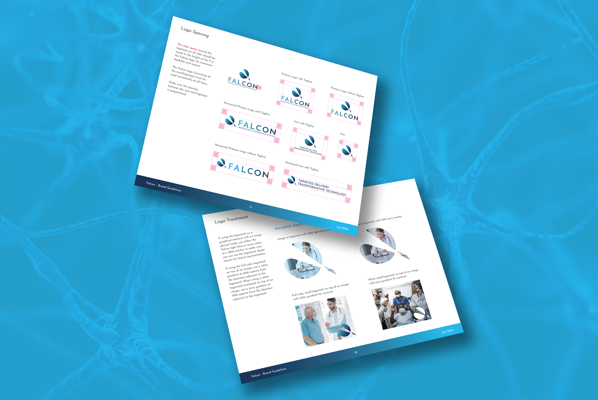 Alcyone Therapeutics / Falcon – Case Study – Image Block 3